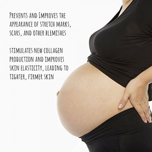 Body Merry Stretch Marks & Scars Defense Oil w All Natural Coconut Oil + Rosehip + Jojoba + Tamanu + Sea Buckthorn to Combat Signs of Stretch Marks,