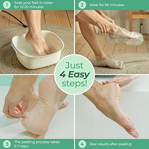 Foot Peeling Mask  1 pair – epielle®