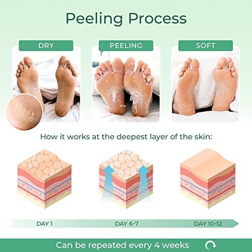 Foot Peeling Mask  1 pair – epielle®