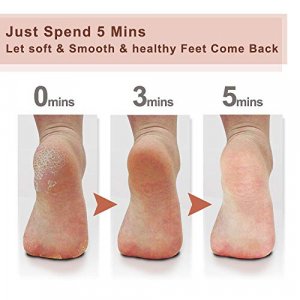  Colossal Innovative Nano Glass Callus Remover Foot