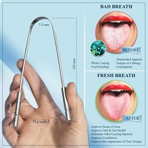 2 Pack Tongue Scraper with Travel Case, Bad Breath Treatment for Adults & Kids, Medical Grade 100% Stainless Steel Tongue Cleaner for Oral Care