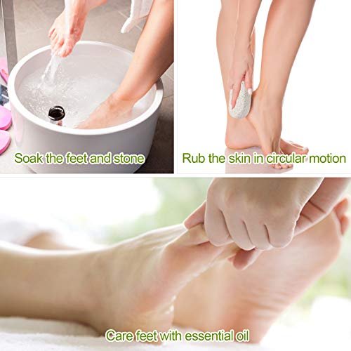 Natural Pumice Stone Tool for Feet and Hands,Pedicure Hard Skin Remover  with Box