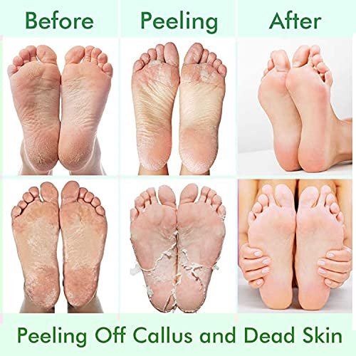Foot Peeling Mask Exfoliating Feet Peel Mask Remove Dead Skin Calluses US