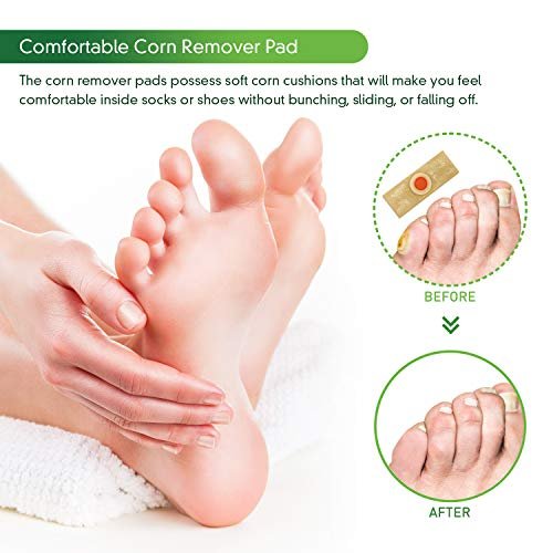 12 Patch Corn Sticker Callus Foot Cushion, Foot Corn Remover Pads