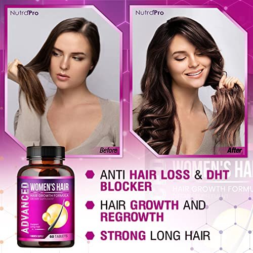 Hair Growth Vitamins For Women - Hair Vitamins For Hair Loss For Women . Regrow & Regrowth Hair Supplement With Dht Blocker,Biotin & Saw Palmetto  For - Shop Imported Products from USA to