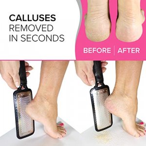 15Pcs Callus Shaver Callus Remover for Feet Heel Hard Skin Corn