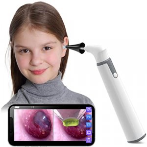 Wireless Otoscope Ear Camera with Dual View, 3.9mm 720PHD WiFi Ear Scope with 6 LED Lights for Kids and Adults, Compatible with Android and iPhone
