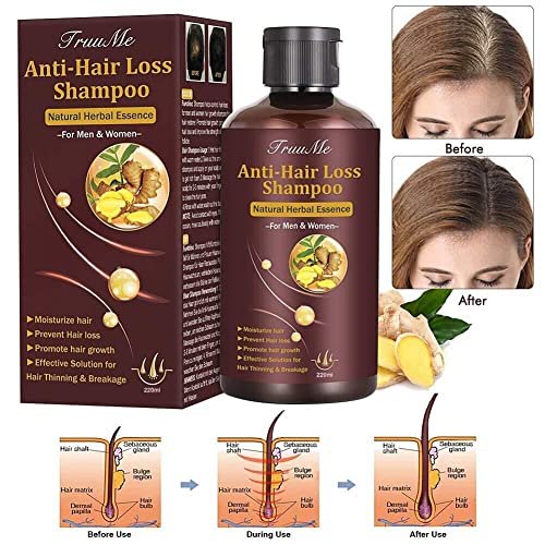Hair Growth Shampoo, Hair Loss Shampoo, Hair Thickening Shampoo, Helps Stop  Hair Loss, Grow Hair Fast, Hair Loss Treatment for Men & Women (220mL) -  Shop Imported Products from USA to India