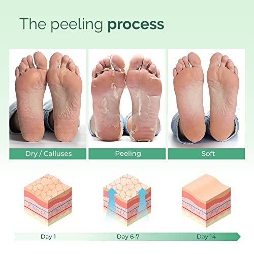 foot peel mask plantifique