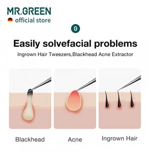 MR.GREEN Ingrown Hair Tweezers Needle Nose Pointed Tips Tweezers For  Eyebrows Splinters Blackhead Removal Acne Clip Extractor (Long)