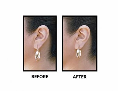  Lobe Wonder - The ORIGINAL Ear Lobe Support Patch for
