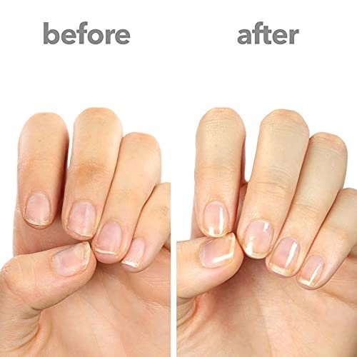 Buy Adiexpress 5 Days Nail Growth Keratin Vitamin E Strong Nail Strengthener  for Thin Brittle Nails Online at Best Prices in India - JioMart.