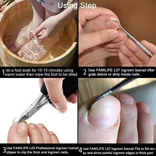 Ingrown toenail file hotsell
