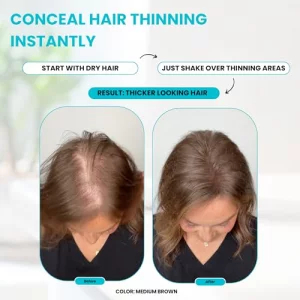 Surethik Hair Fibers For Thinning Hair, Building Hair Fibers To Conceal Thinning Hair, Instantly Fuller Looking Hair For Men & Women, Light Blonde, 3