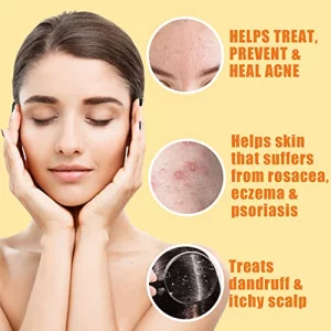 Herblov Cleansing 10% Sulfur Soap Bar For Face & Body Natural Shine Control Facial Cleanser For Acne, Oily Skin Skincare Wash Wit