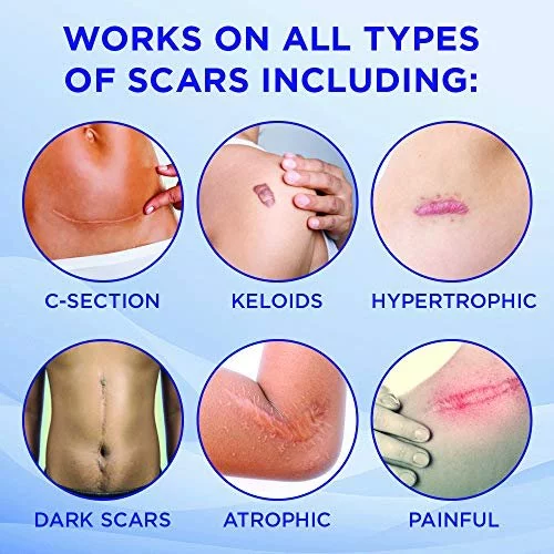 Keloda Scar &amp; Keloid Removal Tea Tree Oil &amp; Massager | For 