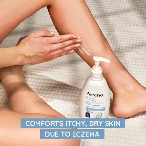 Aveeno Eczema Therapy Daily Moisturizing Body Cream For Sensitive Skin, Soothing Eczema Relief Cream, Colloidal Oatmeal & Ceramide For Dry & Itchy Sk