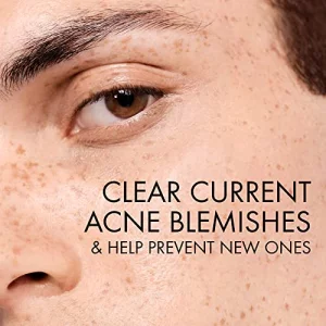 Vichy Normaderm Daily Acne Face Wash, Salicylic Acid Face Cleanser for Oily & Acne Prone Skin, Acne Cleanser that Clears Clogged Pores and Blackheads