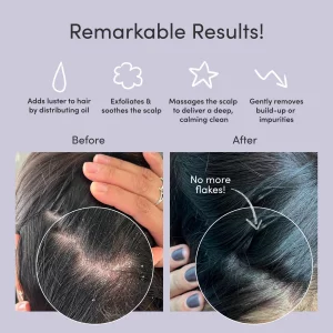 Jupiter Exfoliator Scalp Massager Brush For Wet Or Dry Hair - Detangling Scalp Scrubber Brush - Removes Dandruff & Build-Up - Supports Circulation &