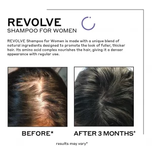 Zenagen Revolve Women'S Hair Loss Duo, 2.5 Fl. Oz.
