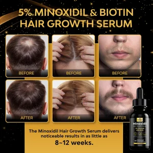 beaueli 5% Minoxidil for Men Hair, Minoxidil for Women Hair Growth, Minoxidil for Men Beard Growth, Minoxidil 5 Percent, Hair Regrowth for Men, Hair 