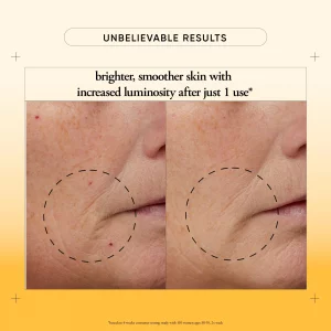 philosophy microdelivery vitamin c resurfacing peel kit - with lactic acid & sunflower seed oil - two-step treatment to smooth rough texture, even sk