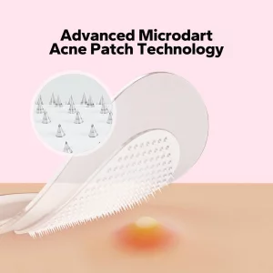 CharmCherry Pimple Patches for Face (18 Count), Microdart Acne Patches, Hydrocolloid Blemish Spot with Salicylic Acid, Fast-Acting for Early Stage De